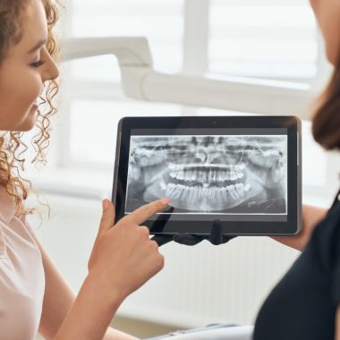 Cum contribuie tehnologia CAD/CAM la adaptarea unei coroane dentare?